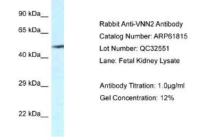 Western Blotting (WB) image for anti-Vanin 2 (VNN2) (C-Term) antibody (ABIN2788913) (VNN2 antibody  (C-Term))