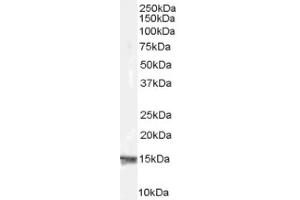 Image no. 1 for anti-Ribosomal Protein S19 (RPS19) (Internal Region) antibody (ABIN374632) (RPS19 antibody  (Internal Region))