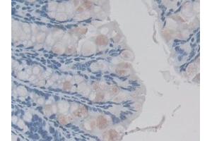 Detection of IL1F9 in Mouse Colon Tissue using Monoclonal Antibody to Interleukin 1 Family, Member 9 (IL1F9) (IL1F9 antibody  (AA 5-149))