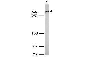 WB Image Sample (50 ug of whole cell lysate) A: Mouse brain 5% SDS PAGE antibody diluted at 1:1000 (Fatty Acid Synthase antibody  (N-Term))