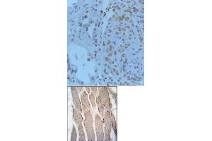 Image no. 2 for anti-Gremlin 1 (GREM1) (C-Term) antibody (ABIN358612) (GREM1 antibody  (C-Term))