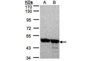 AP31121PU-N ANXA7 antibody staining of 293T (Lane A), A431 (B) whole cell lysates (30 µg) at 1/2000 dilution, 7.