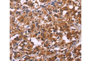 Immunohistochemistry (IHC) image for anti-Spermatogenesis Associated 7 (SPATA7) antibody (ABIN2422217)