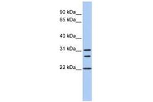 Image no. 1 for anti-Calponin (N-Term) antibody (ABIN6743468) (Calponin antibody  (N-Term))