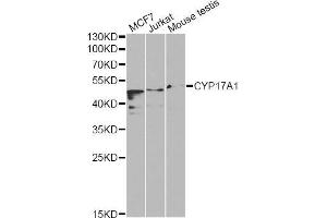 Western blot analysis of extracts of various cell lines, using CYP17A1 Antibody (ABIN5970640) at 1/1000 dilution. (CYP17A1 antibody)