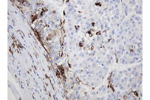 Image no. 2 for anti-Sex Determining Region Y (SRY) antibody (ABIN1501140) (SRY antibody)