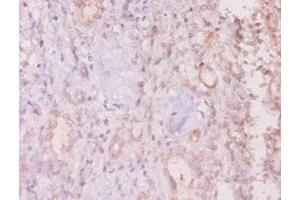 Immunohistochemistry of paraffin-embedded human kidney tissue using ABIN7160281 at dilution of 1:20 (MUC16 antibody  (AA 14067-14328))