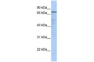 GMPS antibody used at 1 ug/ml to detect target protein. (GMP Synthase antibody  (Middle Region))