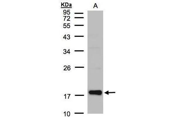 Cofilin 2 antibody  (C-Term)