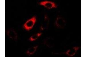 Immunofluorescent analysis of HPPDase staining in U2OS cells. (HPD antibody)