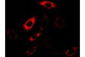 Immunofluorescent analysis of HPPDase staining in U2OS cells. (HPD antibody)