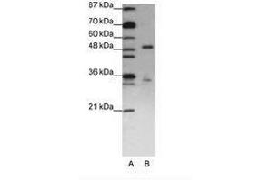 Image no. 2 for anti-UPF3 Regulator of Nonsense Transcripts Homolog B (UPF3B) (N-Term) antibody (ABIN203166) (UPF3B antibody  (N-Term))