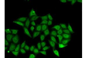 Immunofluorescence analysis of A549 cells using IRF8 antibody. (IRF8 antibody)