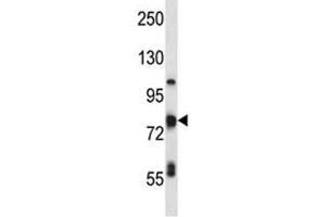 TP63 antibody western blot analysis in MDA-MB231 lysate. (p63 antibody  (AA 651-680))
