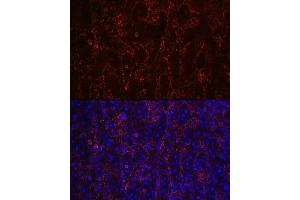 anti-Fc Fragment of IgE, Low Affinity II, Receptor For (CD23) (FCER2) antibody