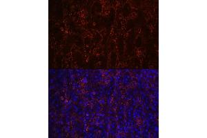 Immunofluorescence analysis of human spleen using CD23 Rabbit mAb (ABIN7267160) at dilution of 1:100 (40x lens). (FCER2 antibody)