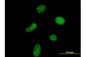 Immunofluorescence of purified MaxPab antibody to UCKL1 on HeLa cell. (UCKL1 antibody  (AA 1-419))