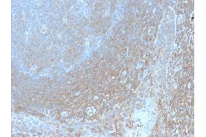 Formalin-fixed, paraffin-embedded human Tonsil stained with BCL10 Recombinant Rabbit Monoclonal Antibody (BL10/2988R).