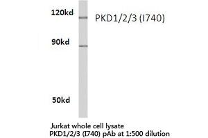 Western blot (WB) analysis of PKD1/2/3/PKC μ antibody in extracts from Jurkat cells. (PKC mu antibody)