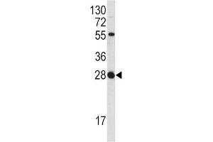Western Blotting (WB) image for anti-Fibroblast Growth Factor 18 (FGF18) antibody (ABIN3002728) (FGF18 antibody)