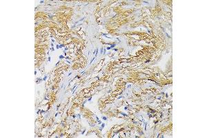 Immunohistochemistry (IHC) image for anti-Wingless-Type MMTV Integration Site Family, Member 3A (WNT3A) (AA 1-352) antibody (ABIN3021019)
