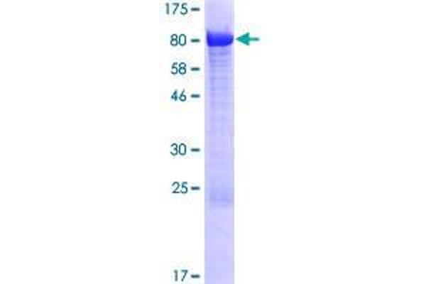 CMIP Protein (AA 1-620) (GST tag)