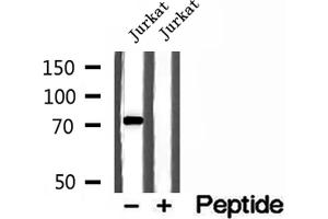 Western blot analysis of extracts of Jurkat cells, using MTO1 antibody. (MTO1 antibody  (N-Term))