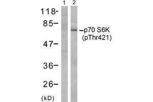 Western blot analysis of extracts from Jurkat cells, untreated or treated with GM-CSF (25ng/ml 30min) using p70 S6 Kinase (phospho-Thr421) antibody (E011254, Line 1 and 2). (RPS6KB1 antibody  (pThr421))