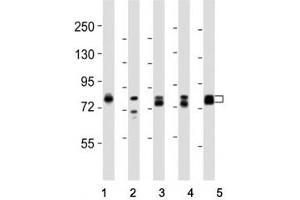 Western blot testing of DNM1L antibody at 1:8000 dilution and lysate from: 1: rat PC12 (Dynamin 1-Like antibody  (C-Term))