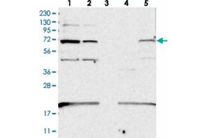 Western blot analysis of Lane 1: RT-4, Lane 2: U-251 MG, Lane 3: Human Plasma, Lane 4: Liver, Lane 5: Tonsil with EEFSEC polyclonal antibody  at 1:250-1:500 dilution. (EEFSEC antibody)