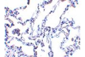 Immunohistochemistry of RRM2B in human lung tissue with RRM2B polyclonal antibody  at 1 ug/mL .