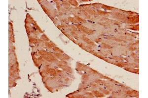 Immunohistochemistry of paraffin-embedded human skeletal muscle tissue using ABIN7143128 at dilution of 1:100 (Actin antibody  (AA 3-377))