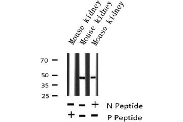 CXCR2 antibody  (pSer347)