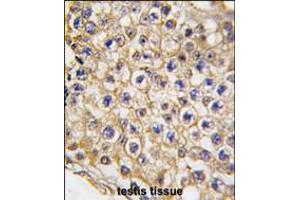 Formalin-fixed and paraffin-embedded human testis tissue reacted with TRPV3 Antibody , which was peroxidase-conjugated to the secondary antibody, followed by DAB staining.