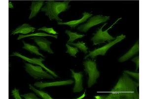 Immunofluorescence of monoclonal antibody to DAPK2 on HeLa cell.