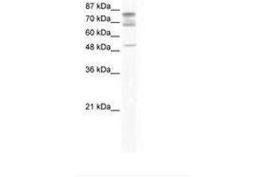 Image no. 1 for anti-DEAD (Asp-Glu-Ala-Asp) Box Polypeptide 46 (DDX46) (C-Term) antibody (ABIN202967) (DDX46 antibody  (C-Term))