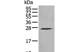 Western blot analysis of Human fetal brain tissue lysate using HAND1 Polyclonal Antibody at dilution of 1:400 (HAND1 antibody)