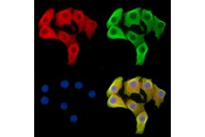 ABIN7096063 and ABIN7100125 staining Hela cells by IF/ICC.