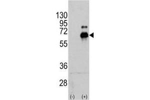 Western Blotting (WB) image for anti-Ribosomal Protein S6 Kinase, 70kDa, Polypeptide 1 (RPS6KB1) (AA 425-454) antibody (ABIN3032481)