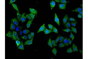 Immunofluorescence staining of Hela cells with ABIN7170160 at 1:33, counter-stained with DAPI. (SLC22A5 antibody  (AA 42-142))