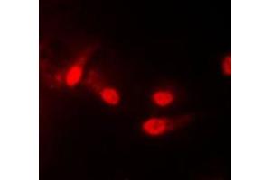 Immunofluorescent analysis of CK1 epsilon staining in HEK293T cells. (CK1 epsilon antibody  (Center))