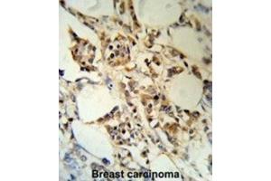 Immunohistochemistry (IHC) image for anti-RNA Binding Motif Protein 3 (RBM3) antibody (ABIN3003187) (RBM3 antibody)
