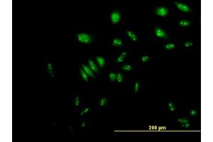 Immunofluorescence of purified MaxPab antibody to NVL on HeLa cell.