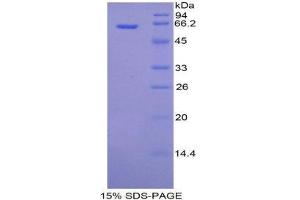 SDS-PAGE (SDS) image for alpha-Fetoprotein (AFP) (AA 31-576) protein (His tag,SUMO Tag) (ABIN2120541) (alpha Fetoprotein Protein (AA 31-576) (His tag,SUMO Tag))