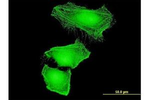 Immunofluorescence of monoclonal antibody to CUL2 on HeLa cell. (Cullin 2 antibody  (AA 1-100))