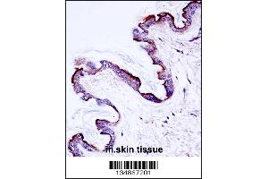 Mouse Prkch Antibody immunohistochemistry analysis in formalin fixed and paraffin embedded mouse skin tissue followed by peroxidase conjugation of the secondary antibody and DAB staining. (PKC eta antibody  (AA 314-341))
