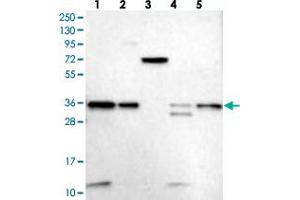 Western blot analysis of Lane 1: RT-4, Lane 2: U-251 MG, Lane 3: Human Plasma, Lane 4: Liver, Lane 5: Tonsil with VPS37B polyclonal antibody . (VPS37B antibody)