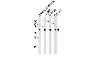 Western blot analysis of lysates from human skeletal muscle, human brain, mouse brain, rat brain tissue (from left to right), using PDK2 Antibody (ABIN659060 and ABIN2838063). (PDK2 antibody)