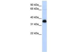 Image no. 1 for anti-Aryl Hydrocarbon Receptor Interacting Protein (AIP) (AA 36-85) antibody (ABIN6744248) (AIP antibody  (AA 36-85))
