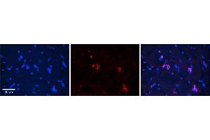 Immunohistochemistry (IHC) image for anti-Nuclear Respiratory Factor 1 (NRF1) (Middle Region) antibody (ABIN2775850)